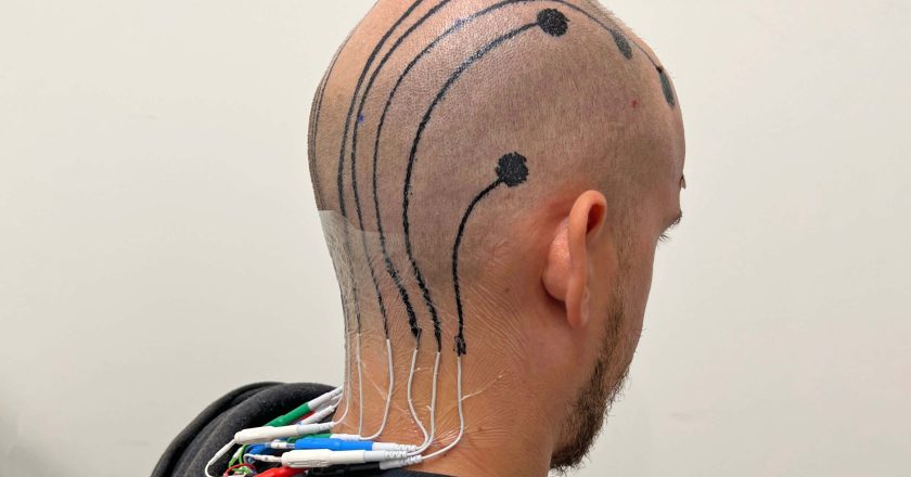 Temporary scalp tattoo can be used to record brain activity