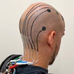 Temporary scalp tattoo can be used to record brain activity